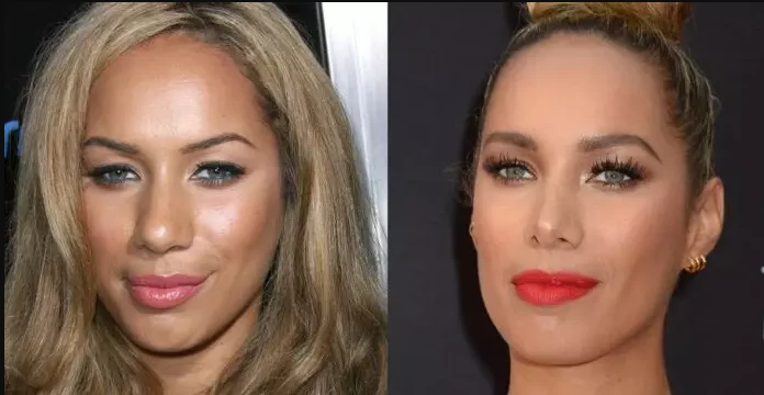 Leona Lewis Plastic Surgery: Did She Really Change Her Face?